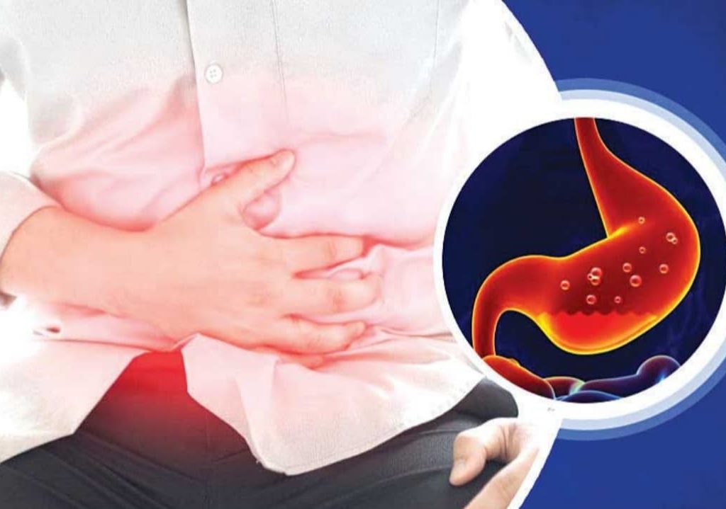 ඔයත් ගෑස්ට්රයිටීස් නිසා පීඩා විදින කෙනෙක්ද ? මෙන්න නිට්ටාවටම ලෙඩේ සුව කරගන්න විදිහ…